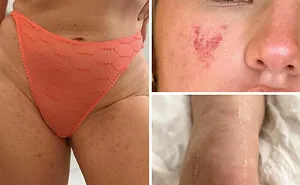 41 Women Post Unedited Pics To “Normalize Normal Bodies”