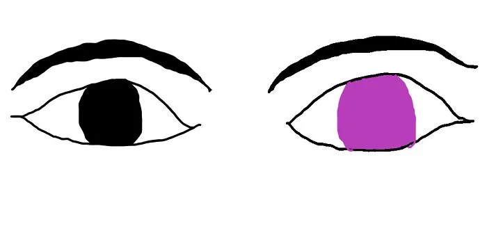 Different Colored Eyes