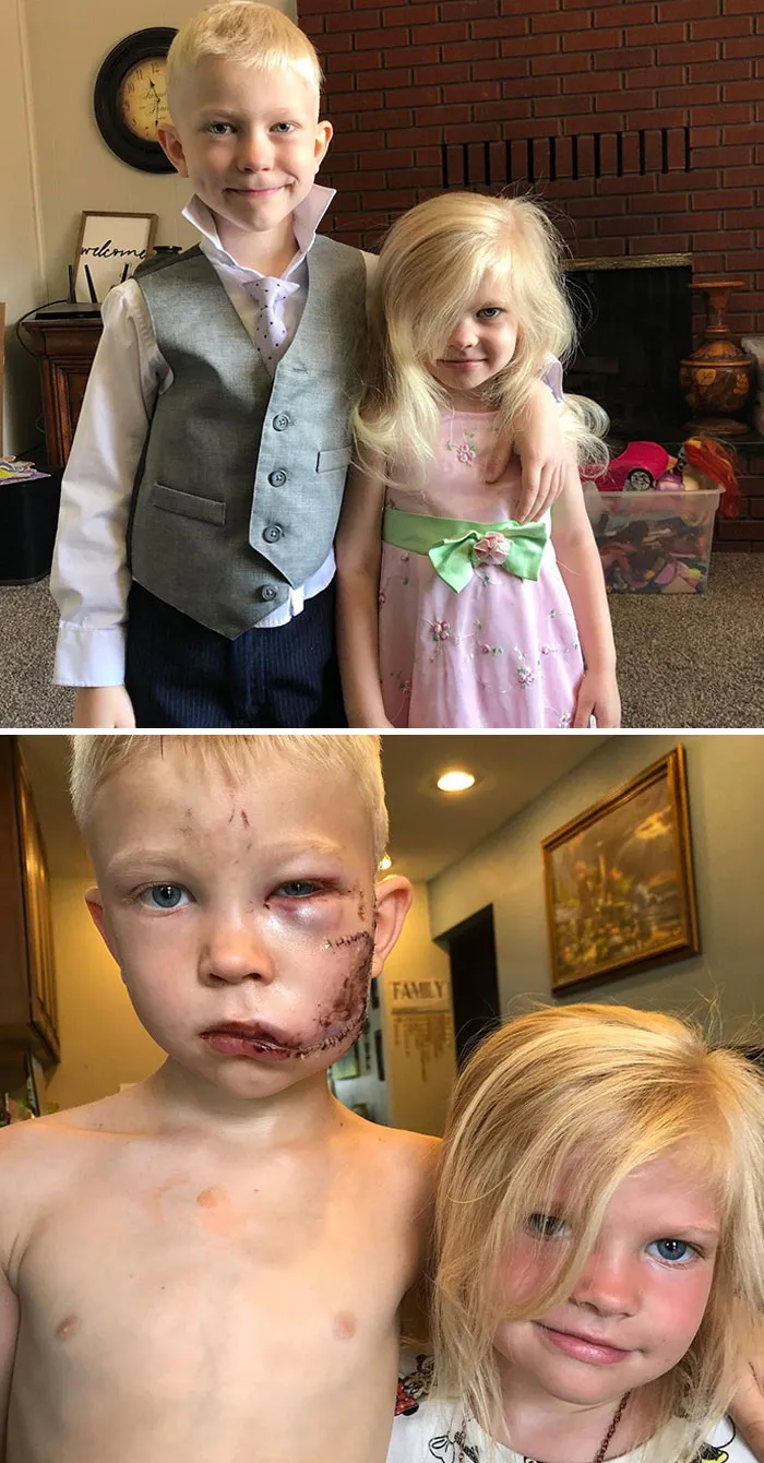 Mi sobrino Bridger, de seis años, salvó la vida de su hermana pequeña al interponerse entre ella y un perro que la embestía