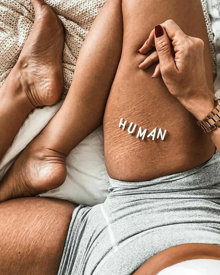 41 Women Post Unedited Pics To “Normalize Normal Bodies”