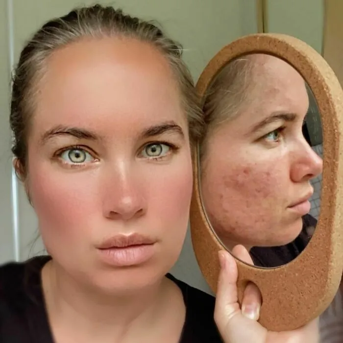 Las mujeres se unen al desafío #FilterDrop en Instagram y comparten 22 rostros sin filtrar para luchar contra el retoque digital en los anuncios de belleza