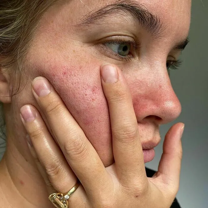 Las mujeres se unen al desafío #FilterDrop en Instagram y comparten 22 rostros sin filtrar para luchar contra el retoque digital en los anuncios de belleza