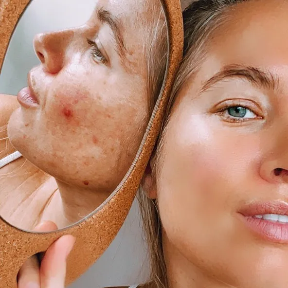 Las mujeres se unen al desafío #FilterDrop en Instagram y comparten 22 rostros sin filtrar para luchar contra el retoque digital en los anuncios de belleza