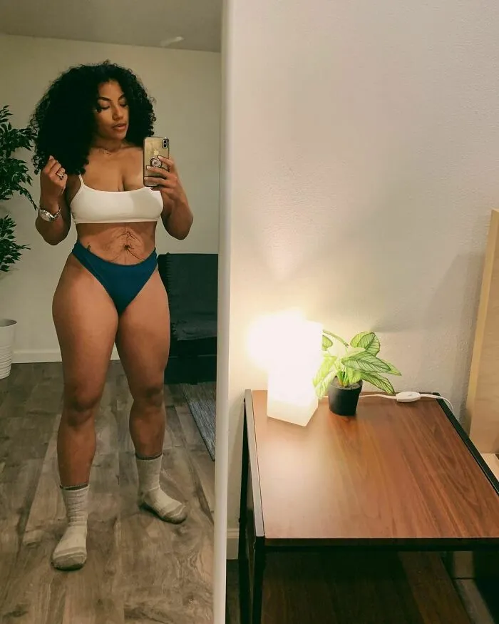 41 Women Post Unedited Pics To “Normalize Normal Bodies”