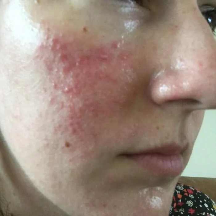 Las mujeres se unen al desafío #FilterDrop en Instagram y comparten 22 rostros sin filtrar para luchar contra el retoque digital en los anuncios de belleza