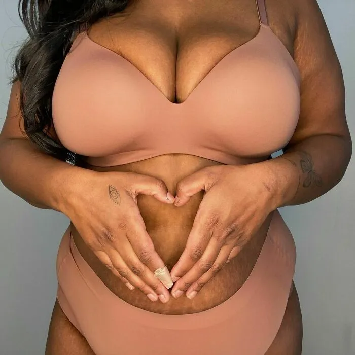 41 Women Post Unedited Pics To “Normalize Normal Bodies”