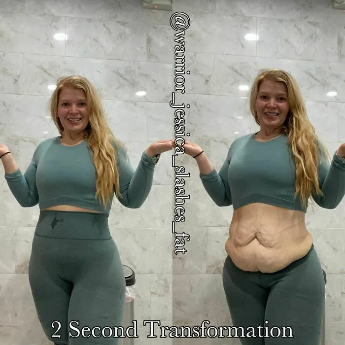 41 Women Post Unedited Pics To “Normalize Normal Bodies”