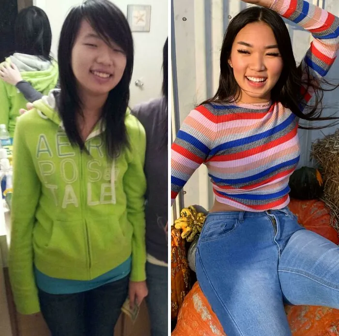 14 To 22 Grew Into My Face And Stopped Hating Every Aspect Of My Existence!