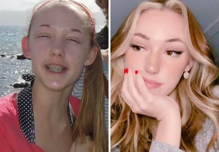 Dyed My Hair, Opened My Eyes, Got Eyebrows...  (13y/O-21y/O)