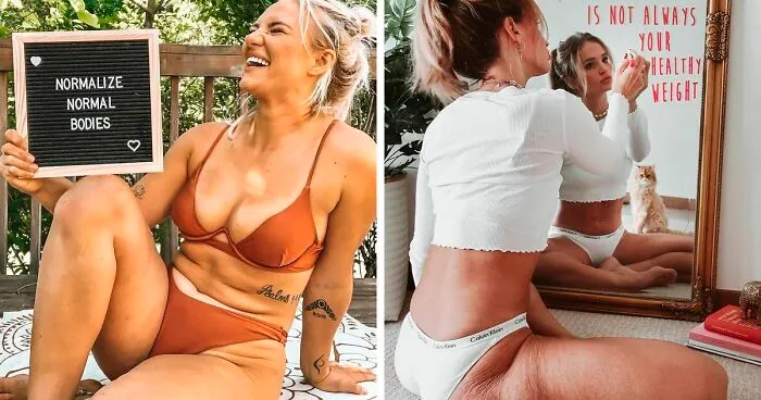 41 Women Post Unedited Pics To “Normalize Normal Bodies”