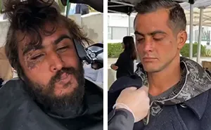 Awesome Barber Transforms Homeless People For Free And These 30 Before & After Pics Show Completely Different People