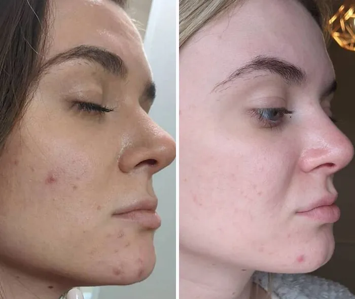 Las mujeres se unen al desafío #FilterDrop en Instagram y comparten 22 rostros sin filtrar para luchar contra el retoque digital en los anuncios de belleza