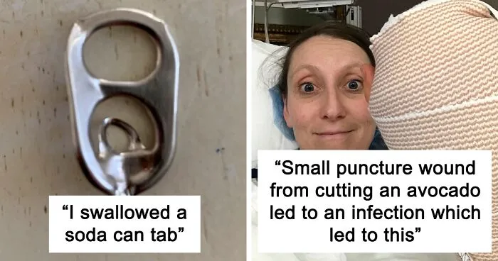 30 Times People Injured Themselves In Dumb Ways And Just Had To Warn Others