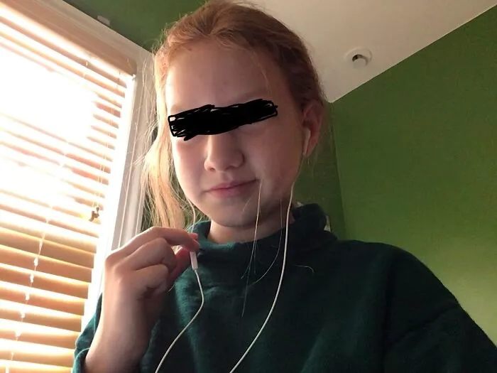 Me ... I Blocked Out My Eyes Just  Because :p Pls Excuse   A C N E