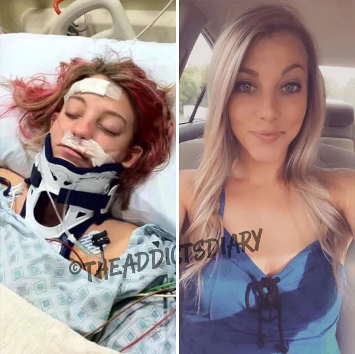 ‘The Addict's Diary' Showcases Before & After Transformations Of People Who Quit Drugs (30 Stories)