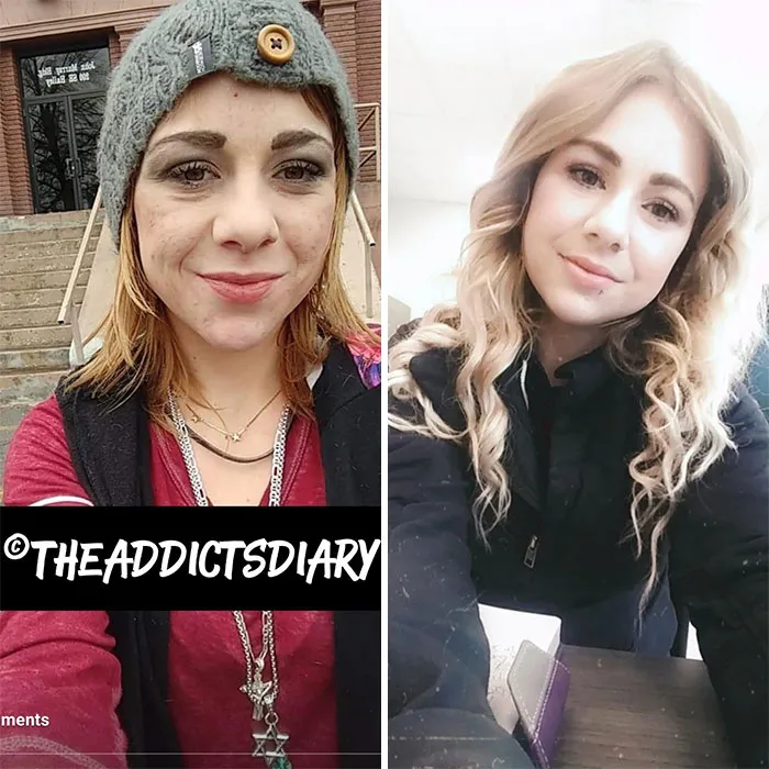 ‘The Addict's Diary' Showcases Before & After Transformations Of People Who Quit Drugs (30 Stories)
