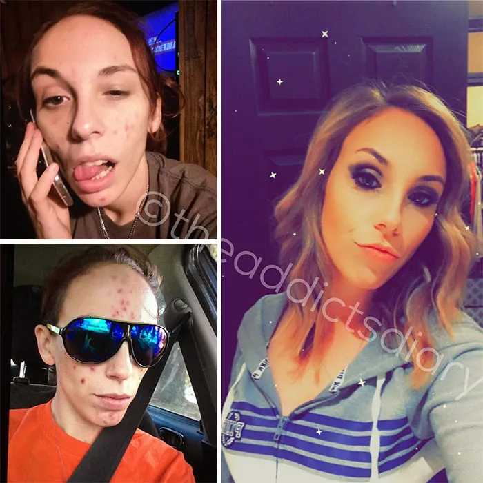‘The Addict's Diary' Showcases Before & After Transformations Of People Who Quit Drugs (30 Stories)
