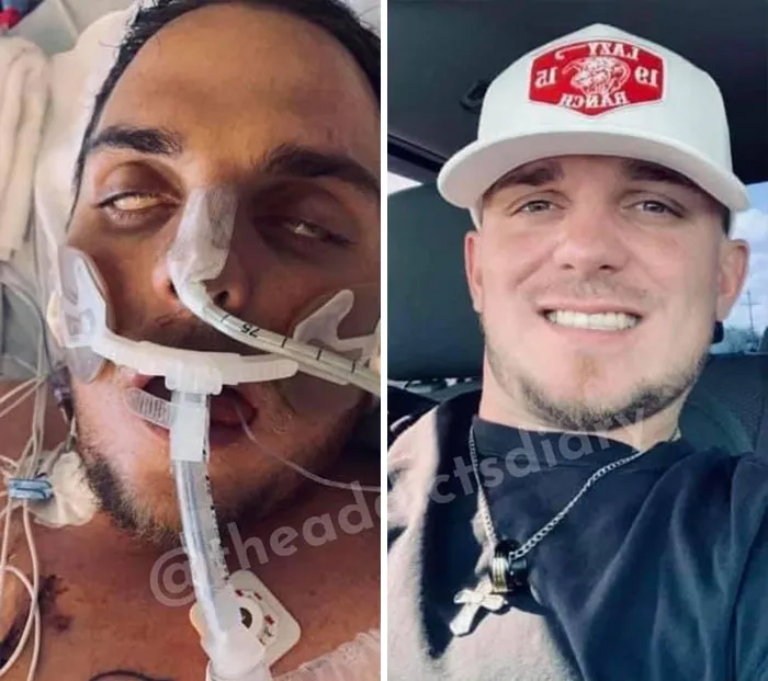 ‘The Addict's Diary' Showcases Before & After Transformations Of People Who Quit Drugs (30 Stories)