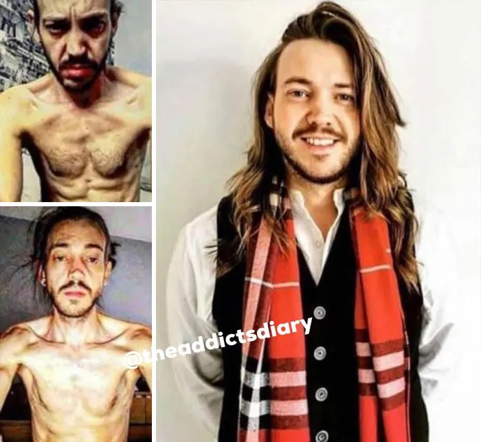 ‘The Addict's Diary' Showcases Before & After Transformations Of People Who Quit Drugs (30 Stories)