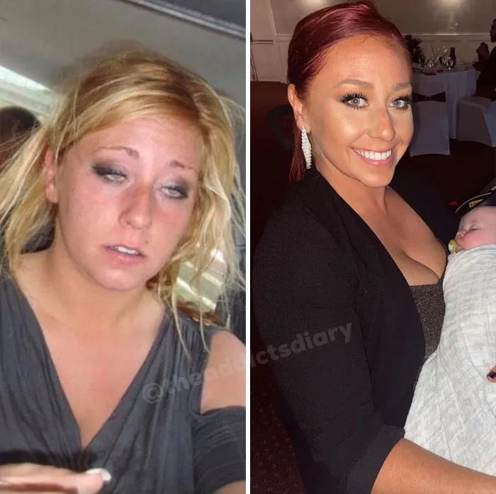 ‘The Addict's Diary' Showcases Before & After Transformations Of People Who Quit Drugs (30 Stories)