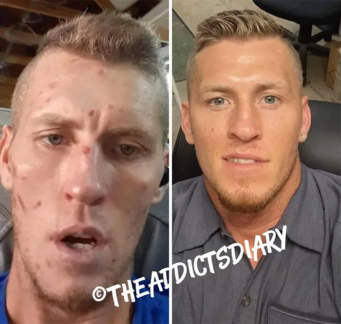 ‘The Addict's Diary' Showcases Before & After Transformations Of People Who Quit Drugs (30 Stories)