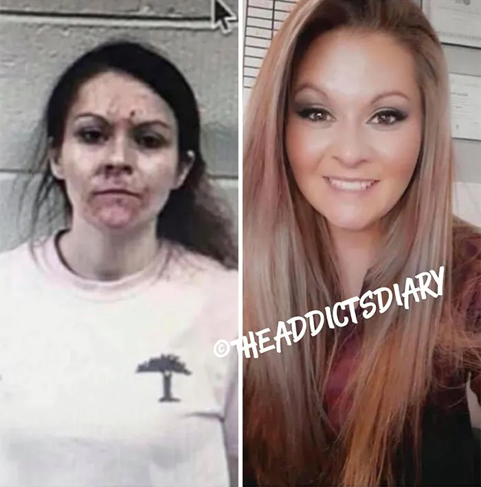 ‘The Addict's Diary' Showcases Before & After Transformations Of People Who Quit Drugs (30 Stories)