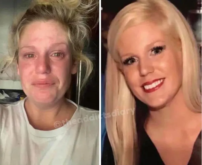 ‘The Addict's Diary' Showcases Before & After Transformations Of People Who Quit Drugs (30 Stories)