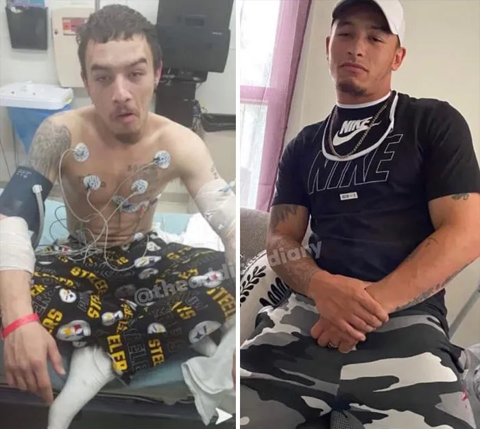 ‘The Addict's Diary' Showcases Before & After Transformations Of People Who Quit Drugs (30 Stories)