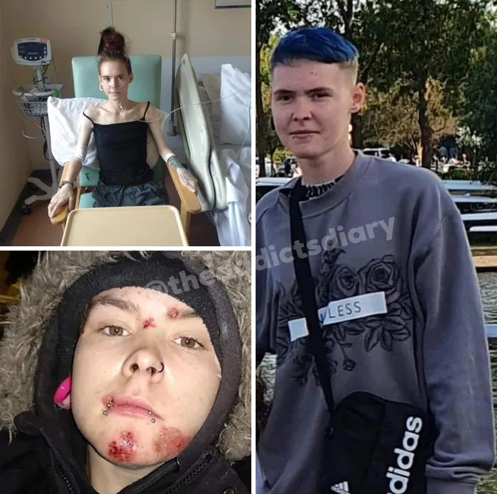 ‘The Addict's Diary' Showcases Before & After Transformations Of People Who Quit Drugs (30 Stories)
