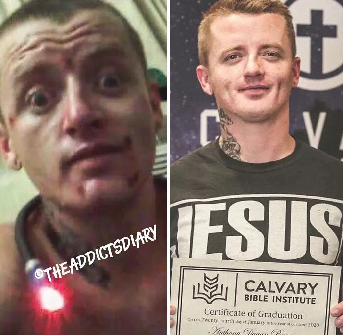 ‘The Addict's Diary' Showcases Before & After Transformations Of People Who Quit Drugs (30 Stories)