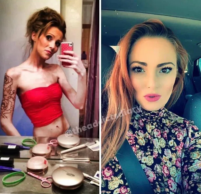 ‘The Addict's Diary' Showcases Before & After Transformations Of People Who Quit Drugs (30 Stories)