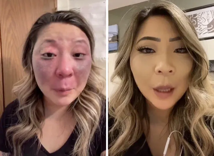 30 People Who Revealed How They Normally Look Vs. How They Make Themselves Look When 'Catfishing'