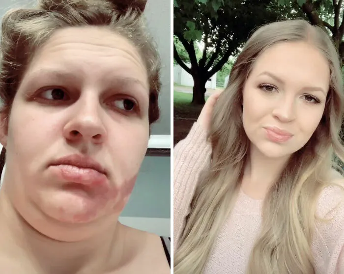 30 People Who Revealed How They Normally Look Vs. How They Make Themselves Look When 'Catfishing'