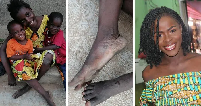 A Homeless Mom Of Two Undergoes An Amazing Transformation After Being Found On The Streets Of Ghana