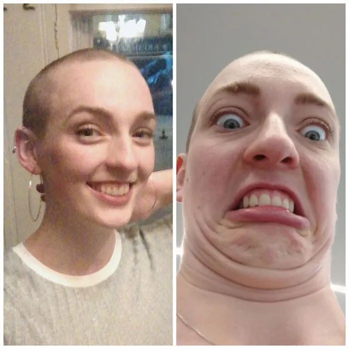 Shaved My Head So I Could Go Full Thumb
