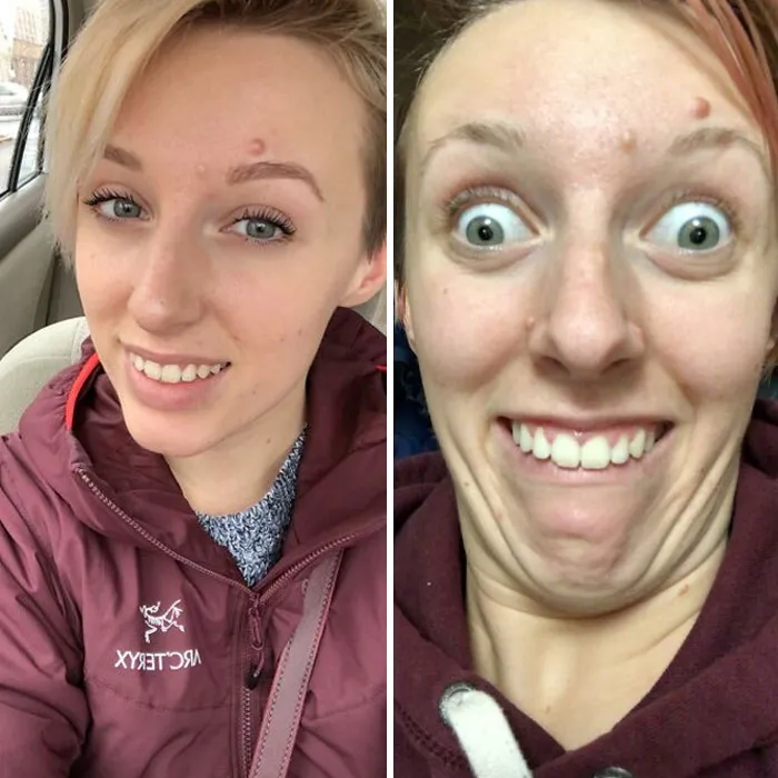 They Say Beauty Knows No Pain. Apparently Ugly Does Because I Gave Myself A Serious Headache Taking The Second Pic