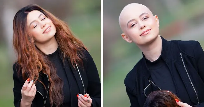 I Captured The Beautiful TV Reporter Who Decided To Embrace Her Alopecia
