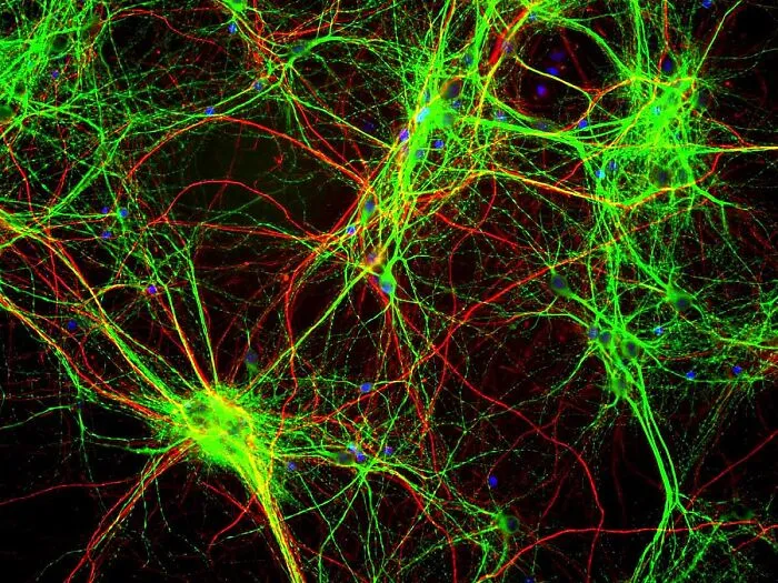 Brain Cells Throwing Shade