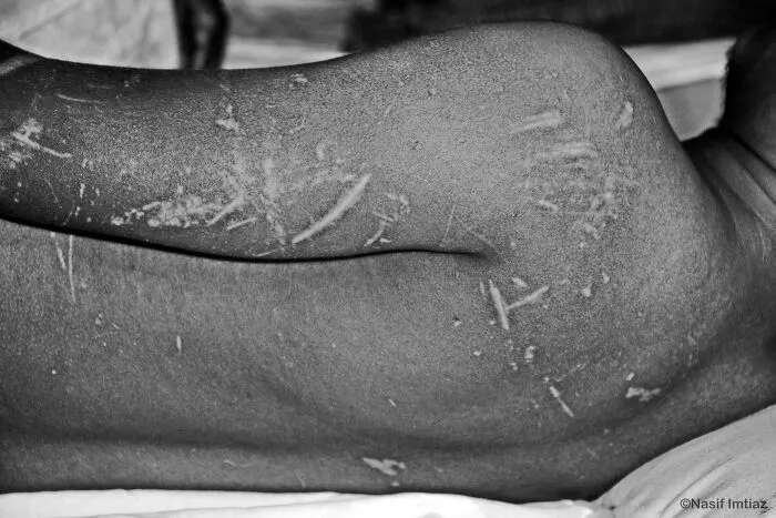 "Can't Remember Anything": My Investigation On The Poor State Of Bangladeshi Mental Hospitals