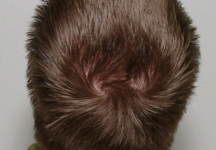 Person Invites You To Learn 'How Rare Is Your Body?' In His Viral Series