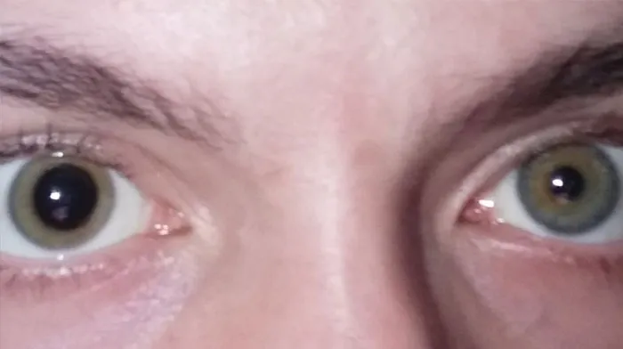 Person Invites You To Learn 'How Rare Is Your Body?' In His Viral Series