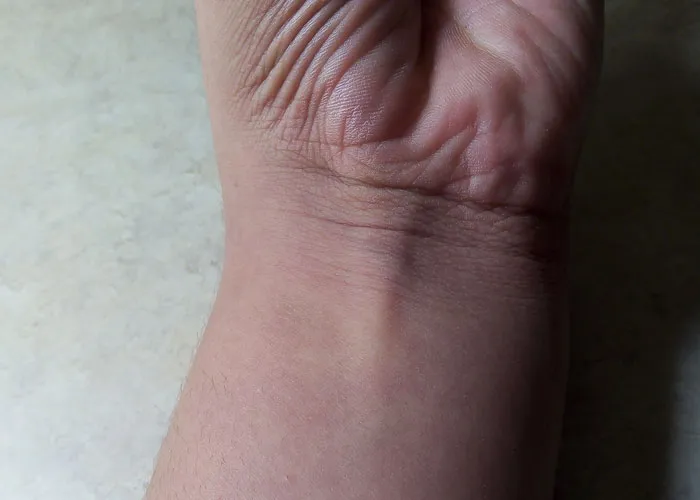 Person Invites You To Learn 'How Rare Is Your Body?' In His Viral Series