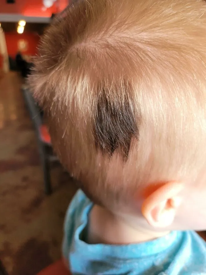 Mi hijo nació con una mancha negra en su pelo rubio. Crece en negro, y no hay ninguna marca de nacimiento o decoloración debajo de ella
