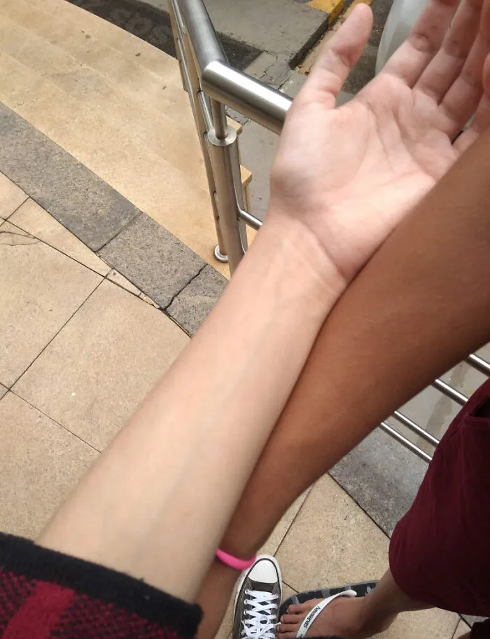 La diferencia en el color de la piel de mi gemelo y la mía. Él sale, yo no