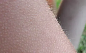 Person Invites You To Learn 'How Rare Is Your Body?' In His Viral Series