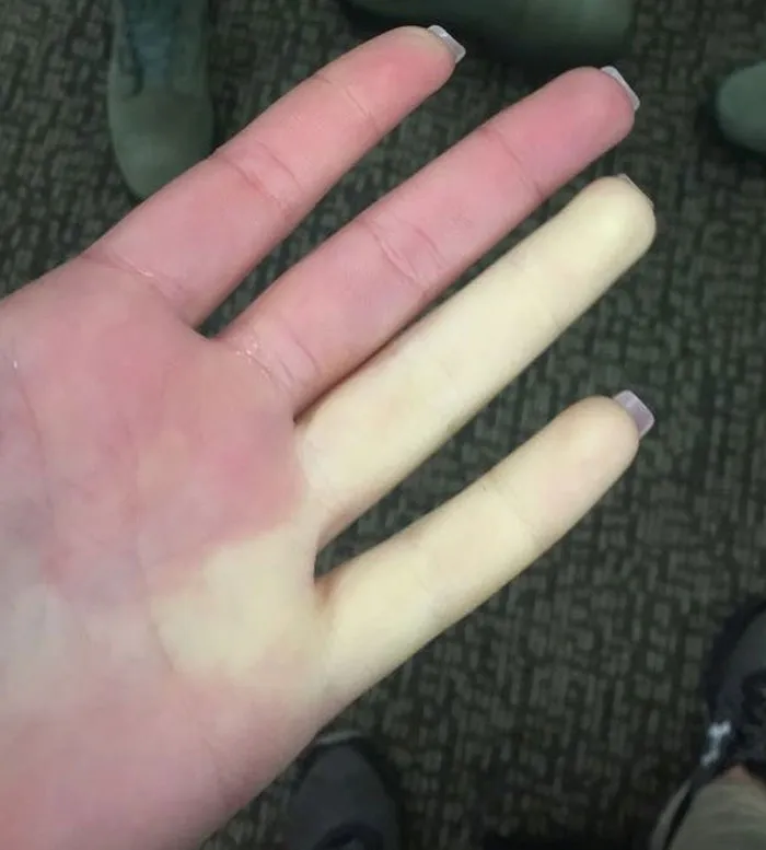 Person Invites You To Learn 'How Rare Is Your Body?' In His Viral Series