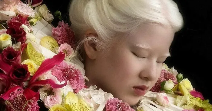 Abandoned As A Baby Due To Albinism, Xueli Grew Up To Become A Vogue Model (30 Pics)