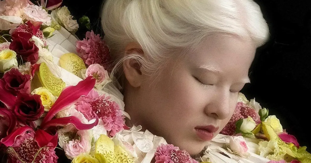 Xueli fue abandonada por ser una bebé albina, pero creció y se convirtió en modelo de Vogue (30 fotos)