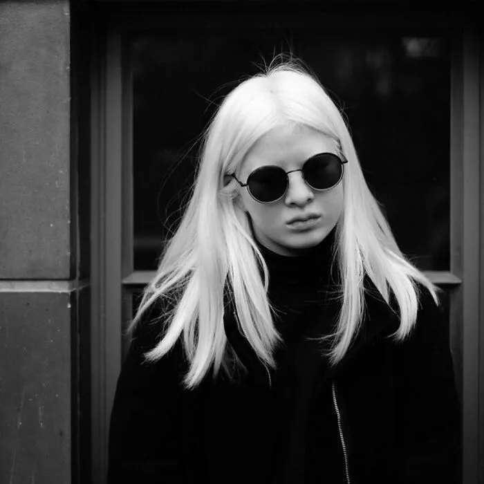 Abandoned As A Baby Due To Albinism, Xueli Grew Up To Become A Vogue Model (30 Pics)