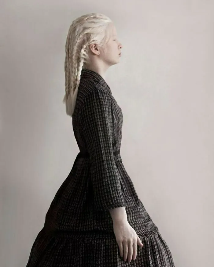 Abandoned As A Baby Due To Albinism, Xueli Grew Up To Become A Vogue Model (30 Pics)